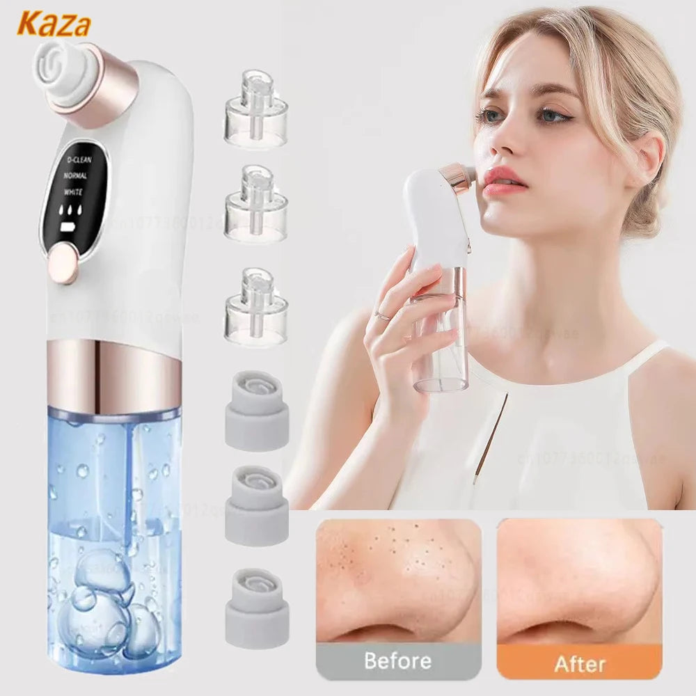 Electric facial blackhead remover.