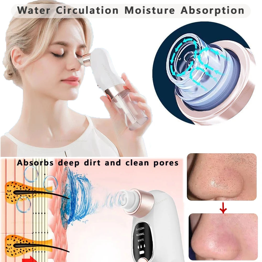 Electric facial blackhead remover.