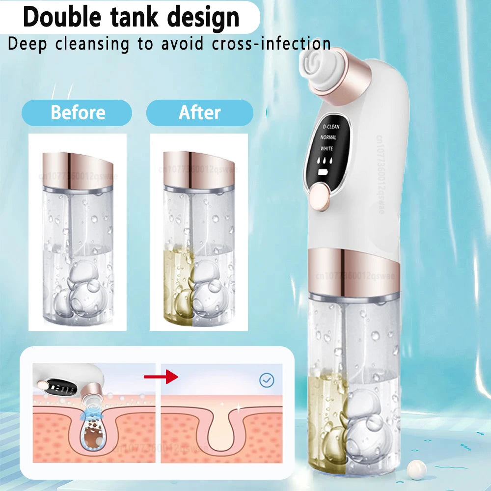 Electric facial blackhead remover.