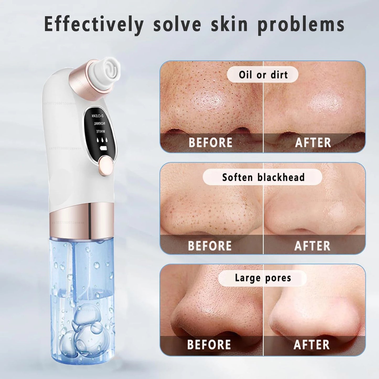 Electric facial blackhead remover.