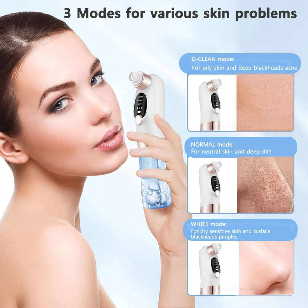 Electric facial blackhead remover.