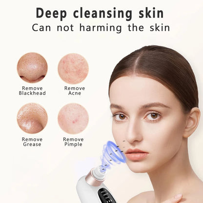 Wellbeauzen™ Deep Pore Akne Pickel Entfernung Vakuumsauger 