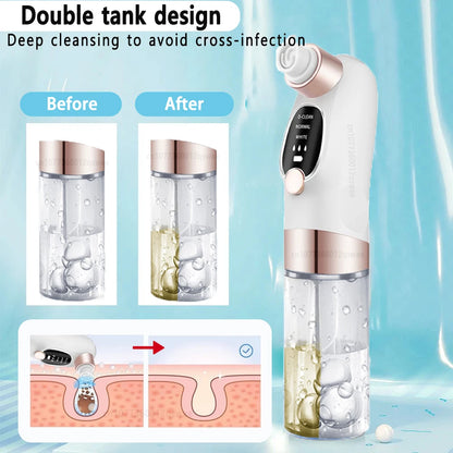 Deep Pore Cleaner Vacuum.